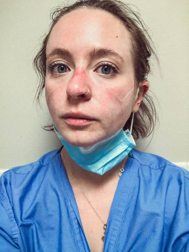 Nurse Shows Her Changes After Nine Months Of Pandemic