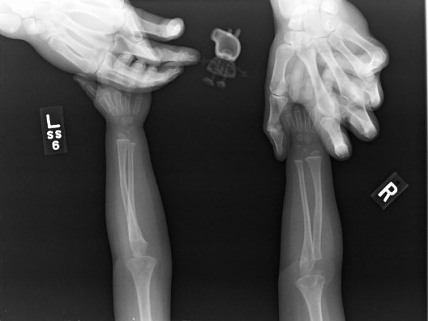 Things Under X-Rays