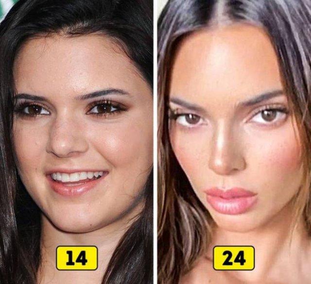 Celebrity Changes In The Past 10 Years