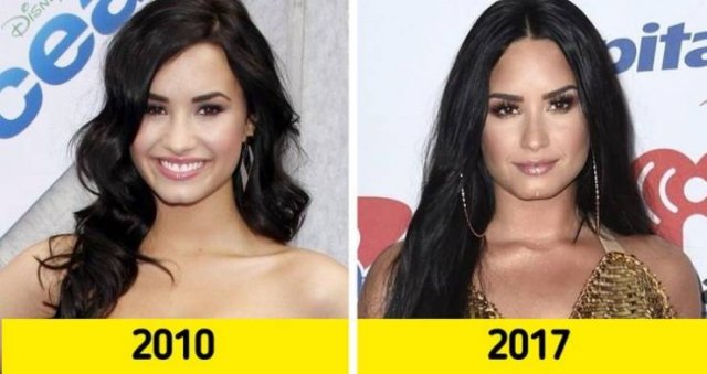 Dramatic Celebrity Changes