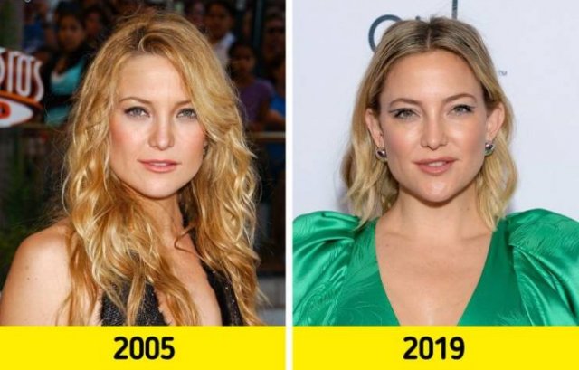 Celebrities Who Refuse Aging
