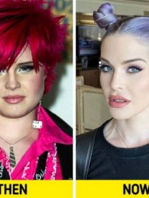 Celebrities From The 00's: Then And Now