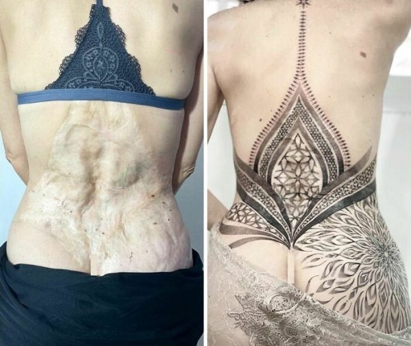 Creative Tattoos That Cover Scars