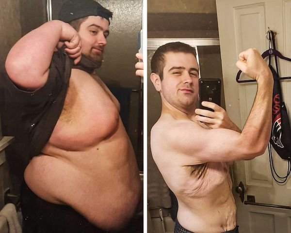 Amazing Weight Loss, part 9