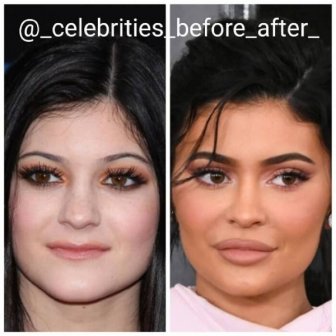 Celebrity Changes