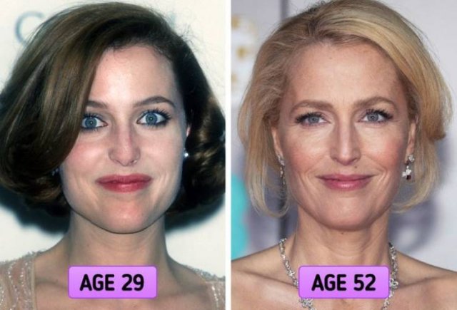 Celebrities Who Prefer Natural Aging