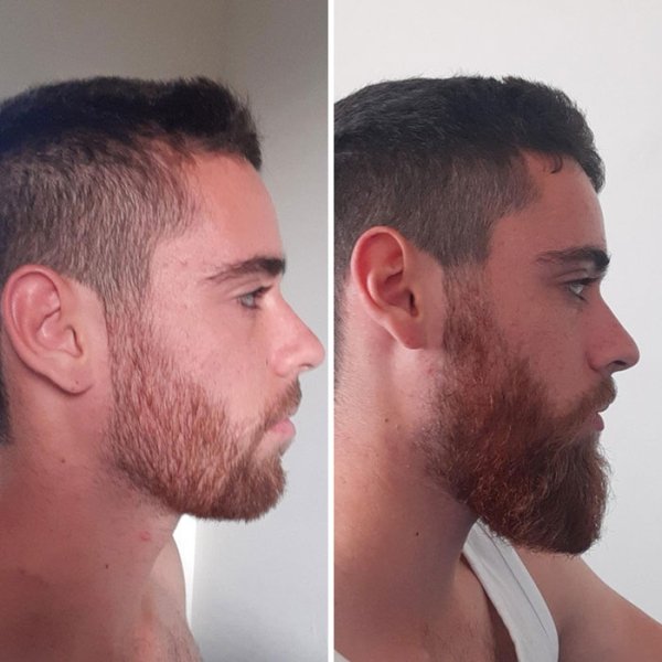 Men After Shaving