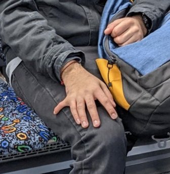 Unusual Body Features