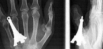 Unusual X-Ray Photos