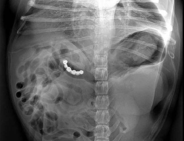 Unusual X-Ray Photos
