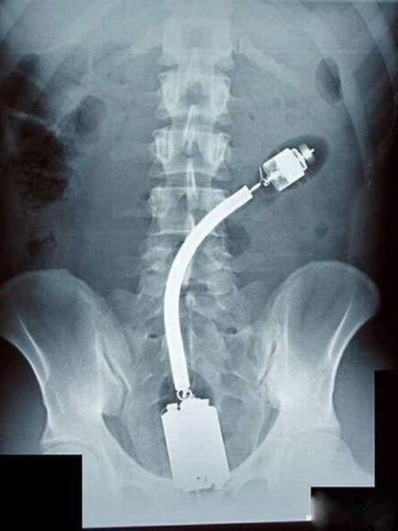 Unusual X-Ray Photos