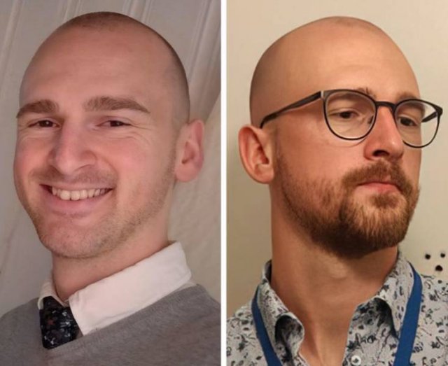 With And Without Beard, part 4