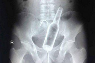 Weird Objects On X-Rays