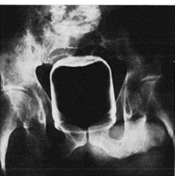 Weird Objects On X-Rays