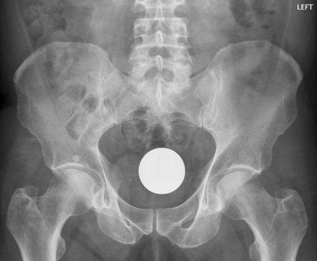 Weird Objects On X-Rays
