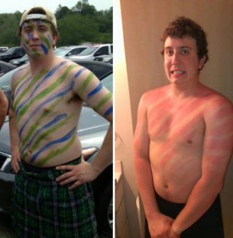 Funny Sunburns