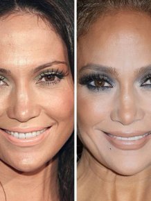 How Celebrities Faces Are Changing