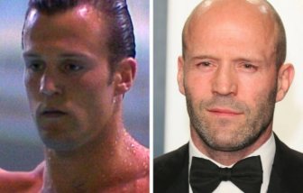 Famous Men With And Without Hair