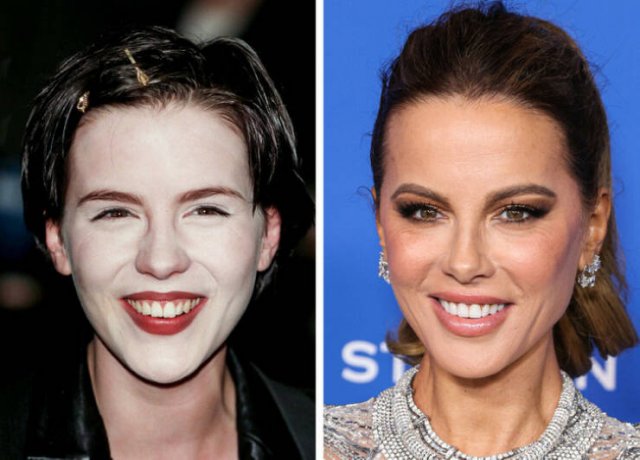Celebrities Who Changed Their Smiles