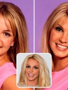 Famous People And Plastic Surgeries