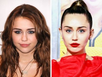 Celebrities Before And After Plastic Surgery