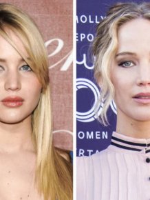 Famous Women Before And After Plastic Surgery