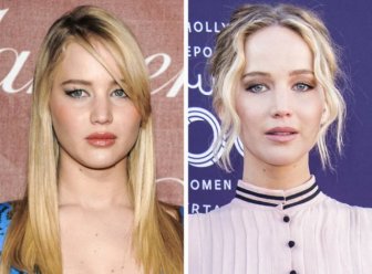 Famous Women Before And After Plastic Surgery