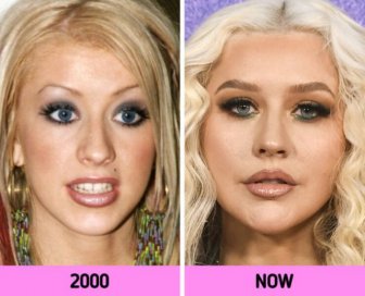 How Faces Of Celebrities Changed Over The Years