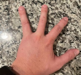 People With Unique Features